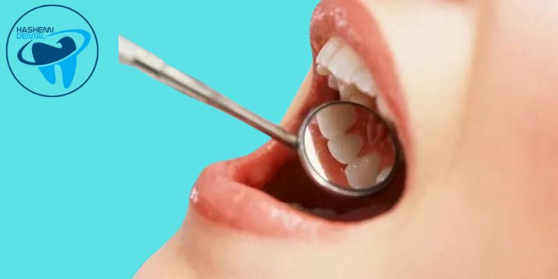 انواع وسایل دندان پزشکی